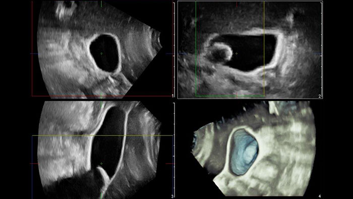 Q-App General Imaging 3D Quantification thumbnail