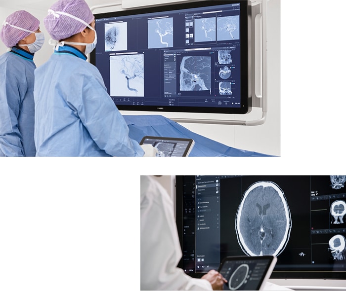 The smart CT solution simplifies 3D aquisition with step by step guidance that empowers clinical users to easly perform 3D imaging