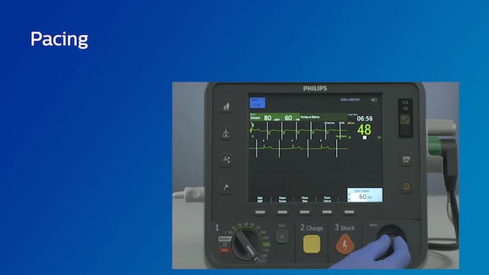 Non-invasive transcutaneous video