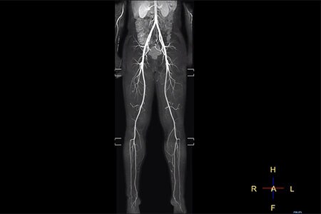 fat free motion free imaging