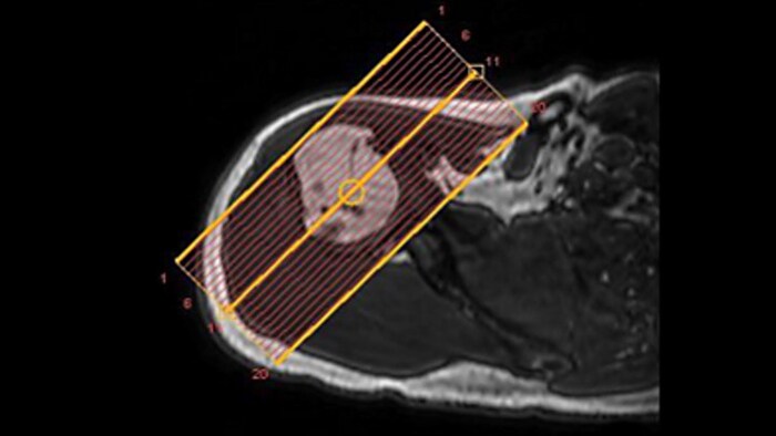 Consistent MRI results