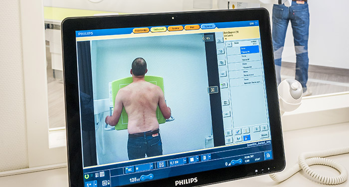 DigitalDiagnost C90 at LangeLand Hospital