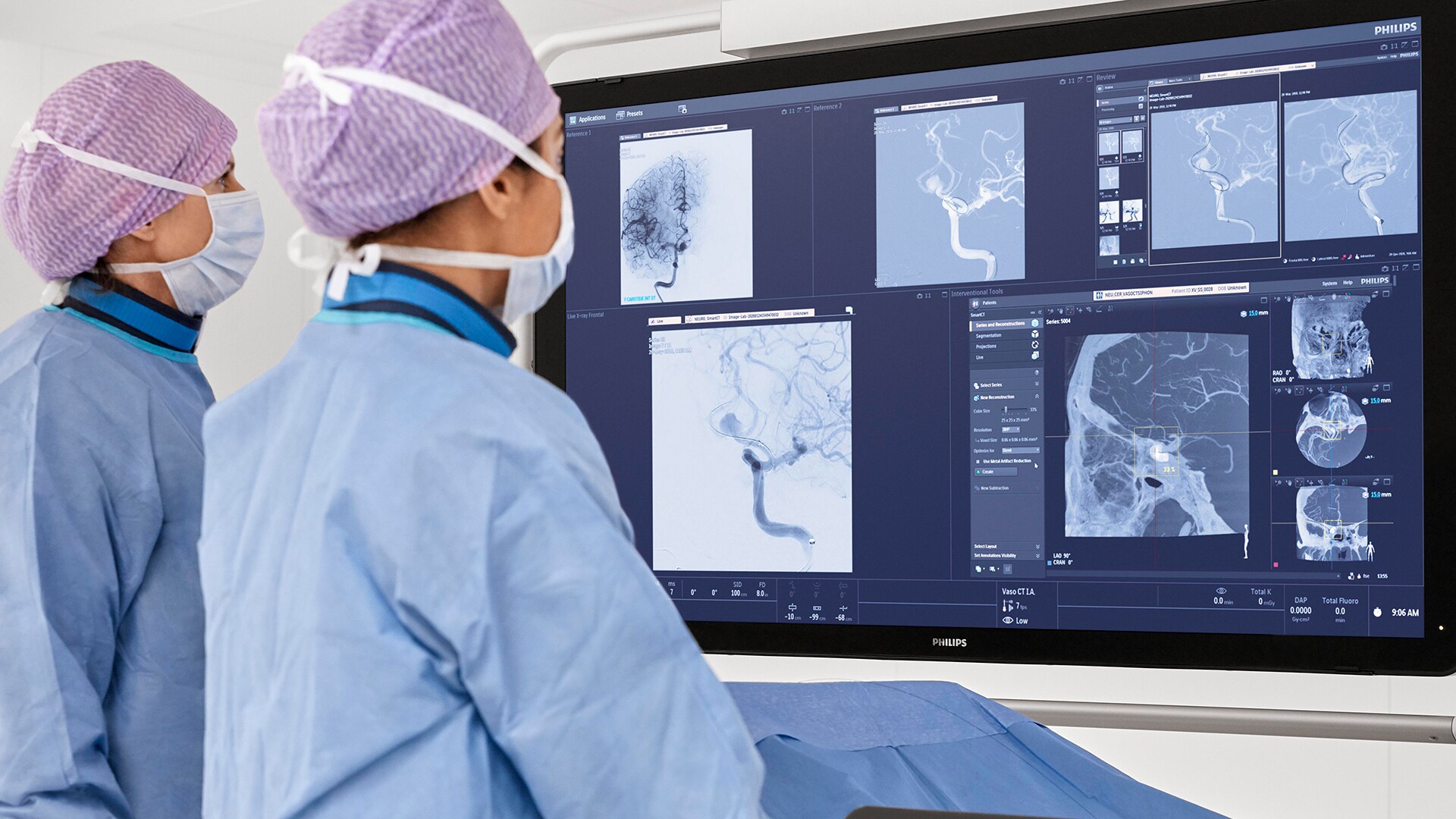 Philips' direct-to-angio stroke pathway: new analysis demonstrates substantial cost savings in addition to improved patient outcomes